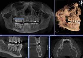 3D-Diagnostik m. DVT.jpg